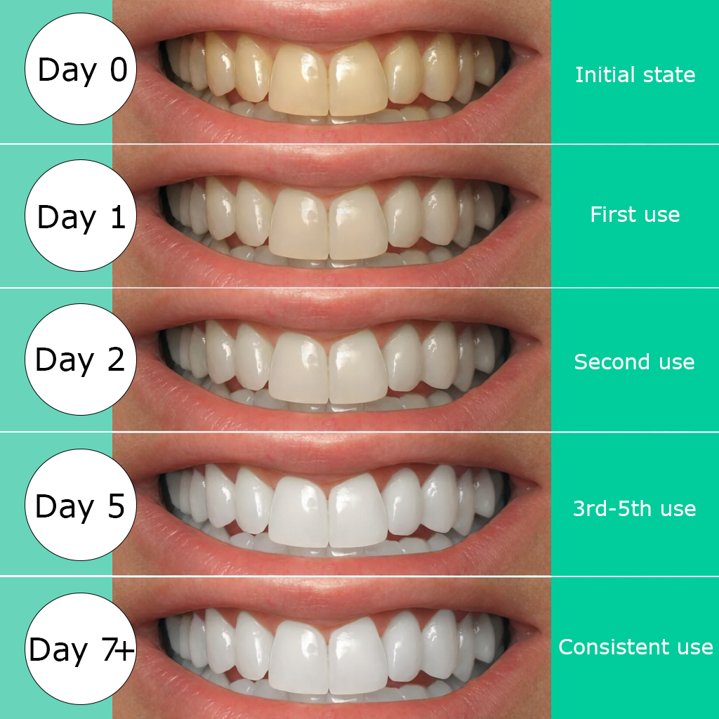 Healthaware™ Teeth Whitening Strips - Unlock an Almost Perfect Smile From Your Bathroom